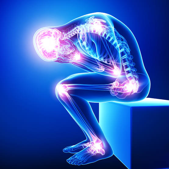 Multi-region chronic pain anatomical illustration